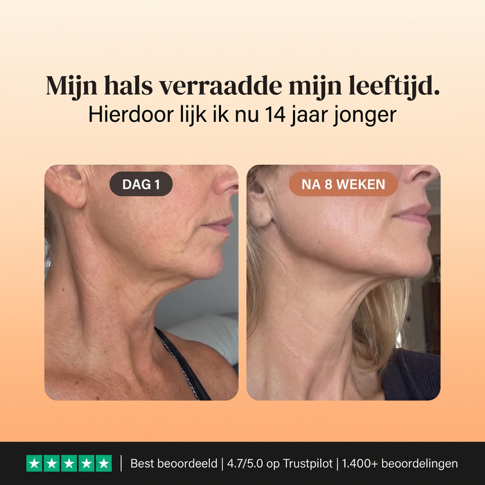 Voor en na: hals en decolleté
