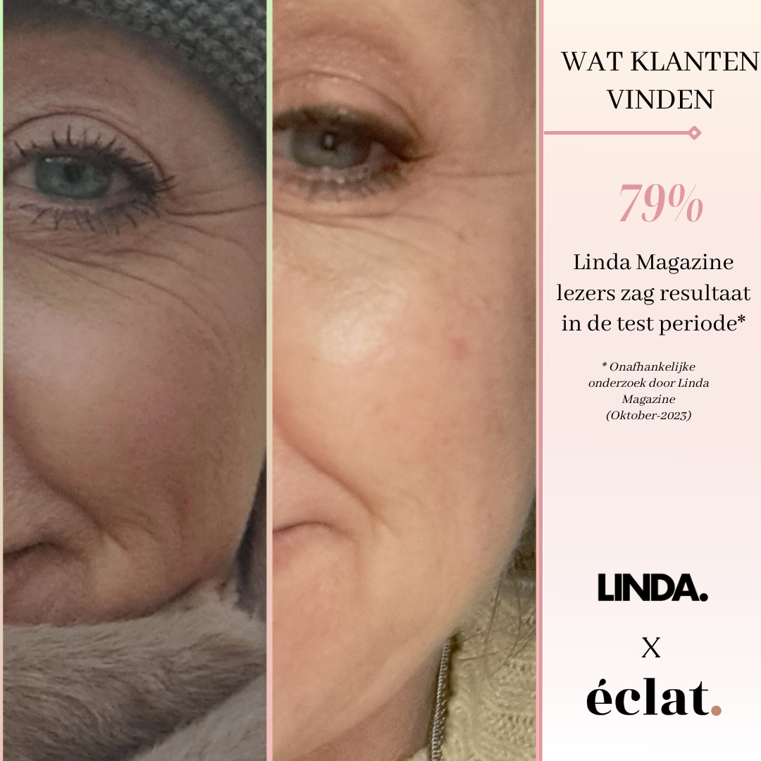 Lezerstest met LINDA. Magazine